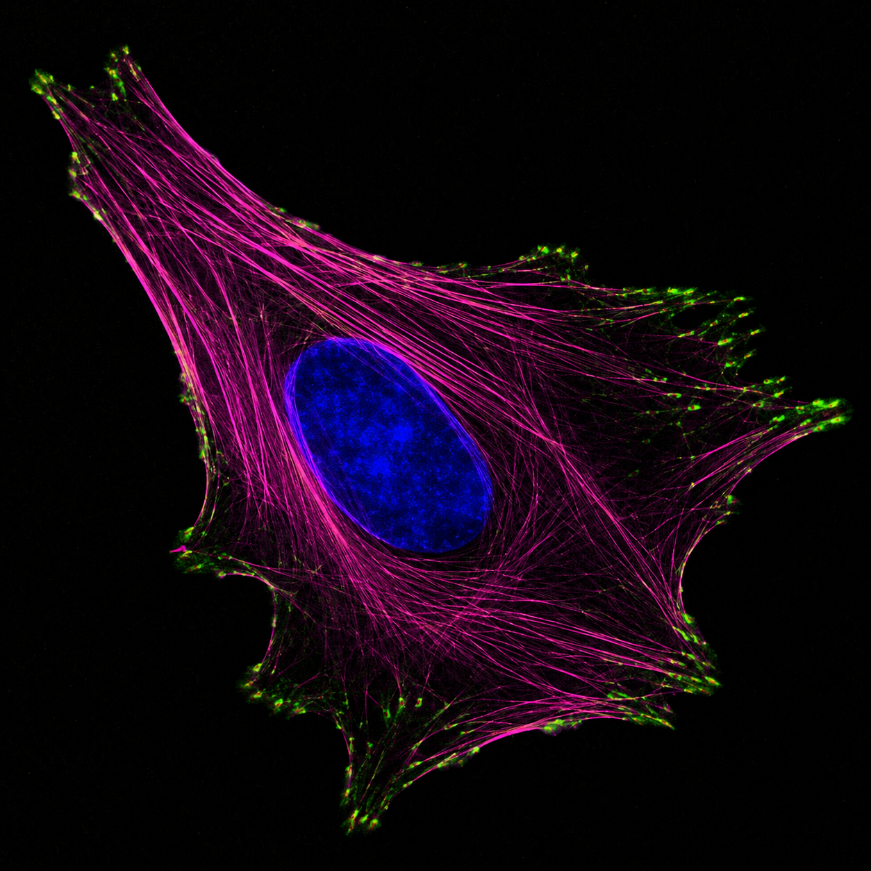 STED microscopy cell image with magenta cytoskeleton and blue nucleus