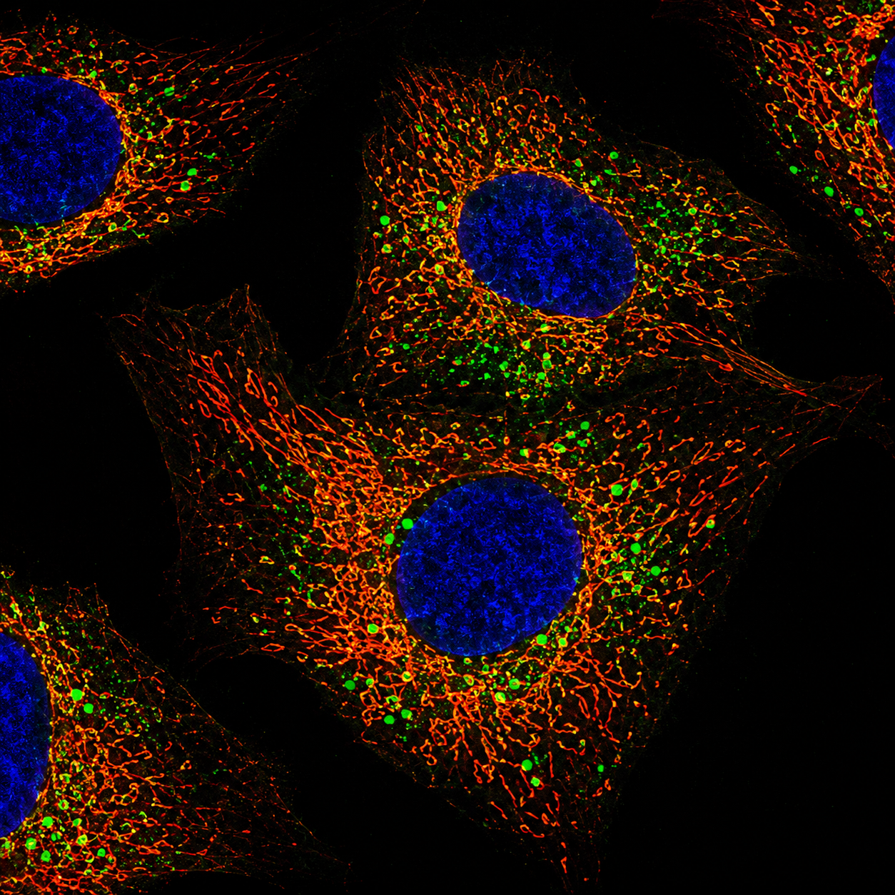 STED microscopy image with orange mitochondria and blue nuclei