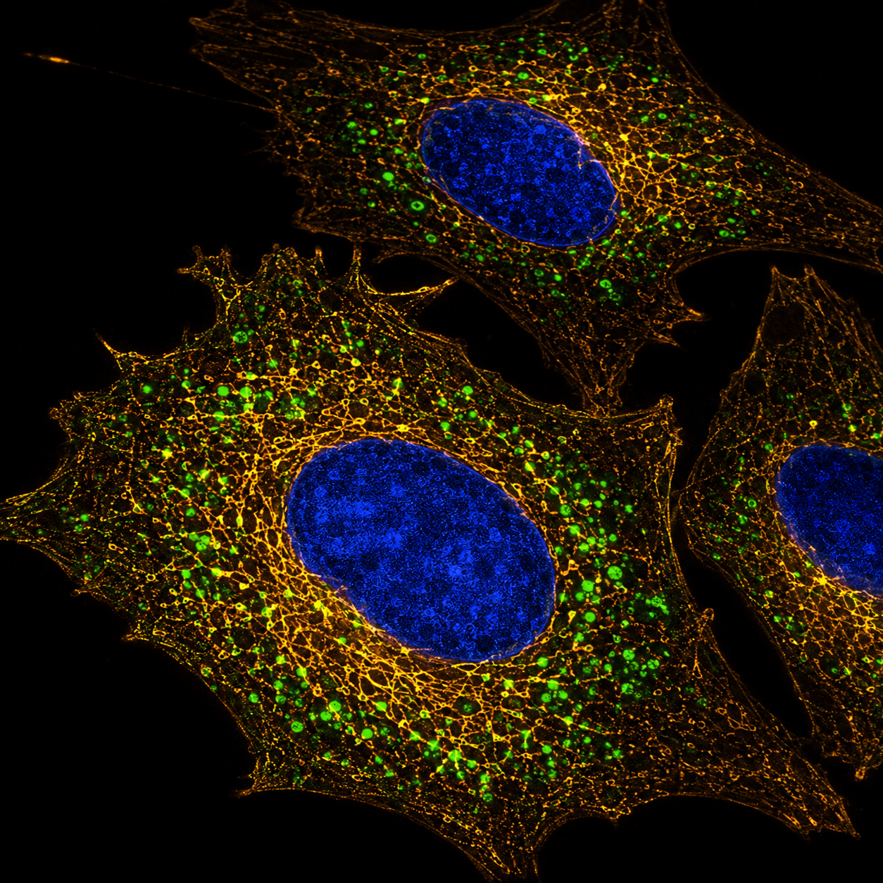 STED microscopy image with gold and green cellular staining